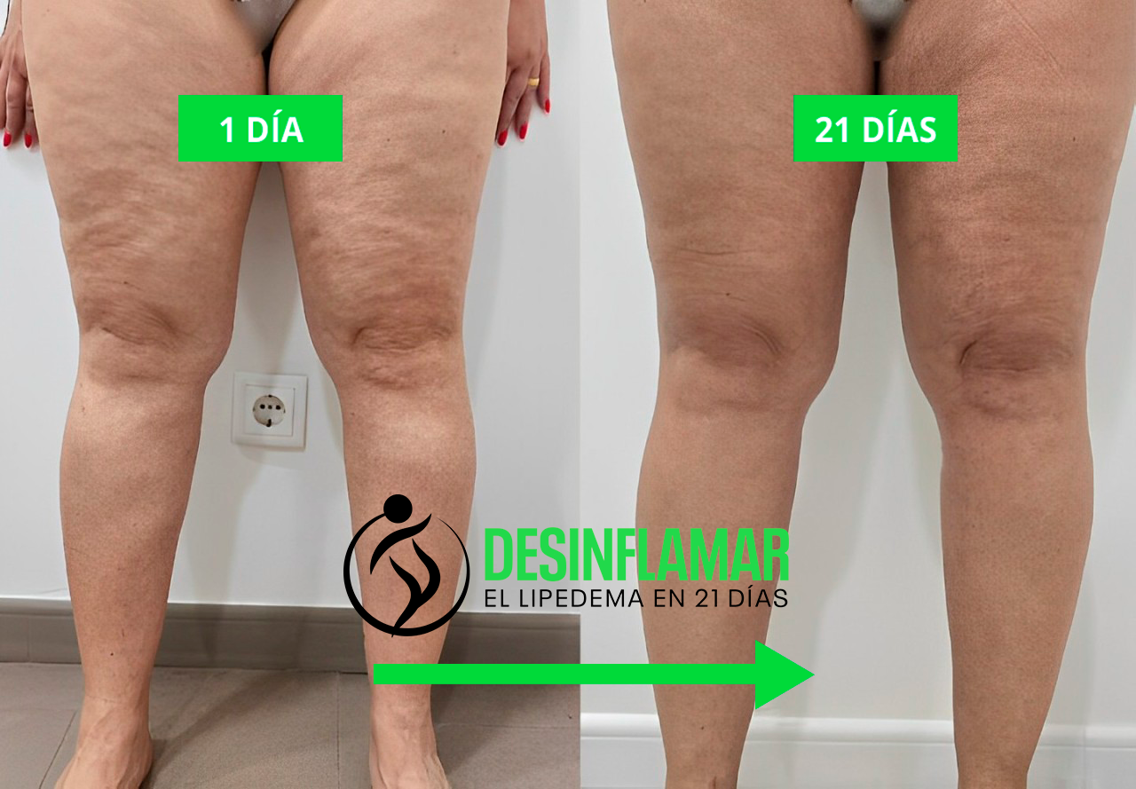 antes-e-depois2